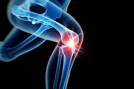 Joint replacement surgery Dubai