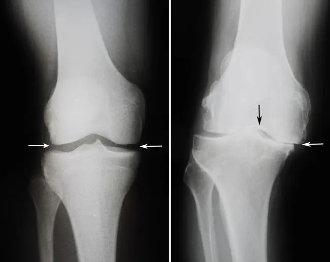 Orthopaedic evaluation