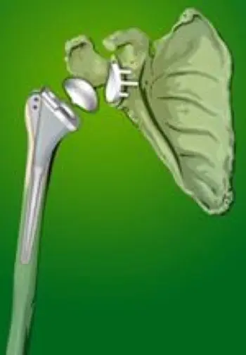 Shoulder joint illustration