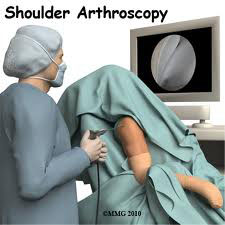 Shoulder 2