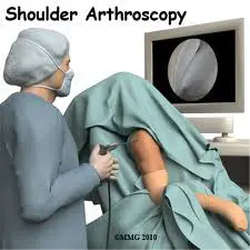 Shoulder 2
