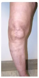 Orthopaedic surgery