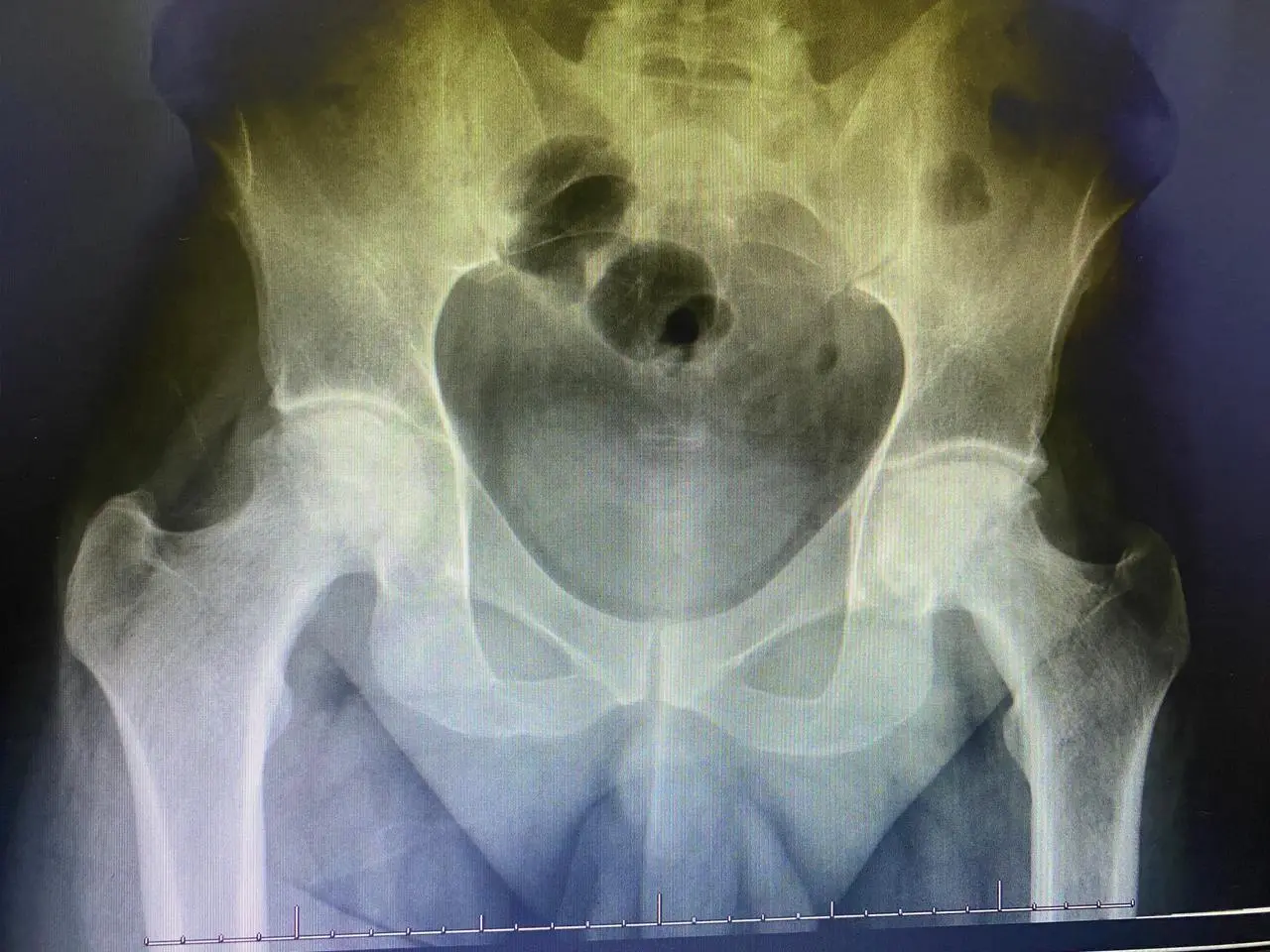 Patient testimonial photo