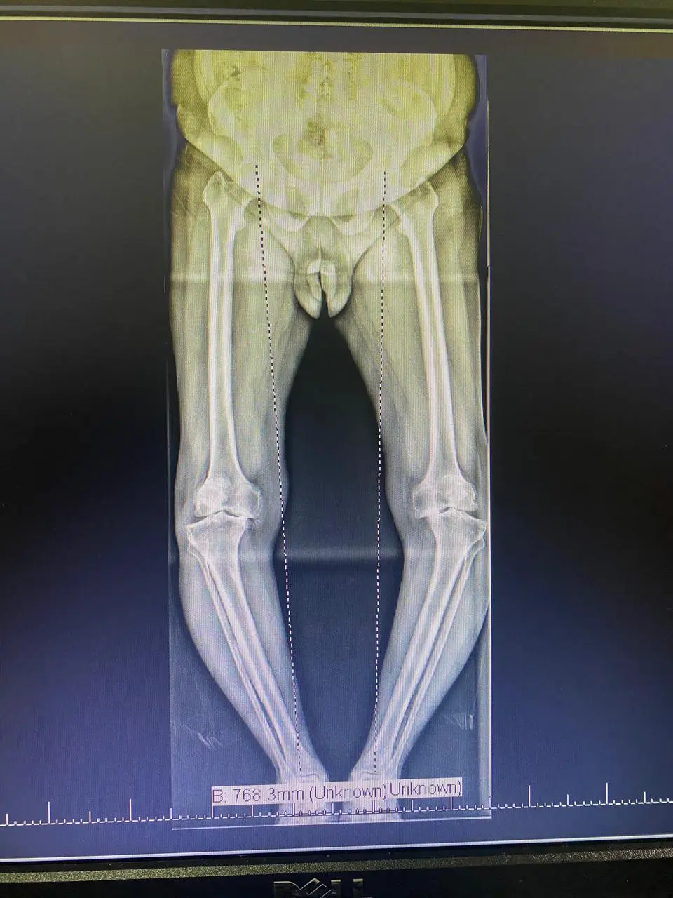Patient testimonial photo